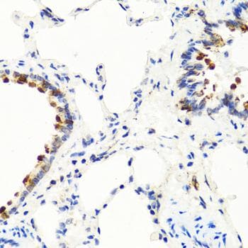 NTF3 / Neurotrophin 3 Antibody