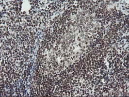 TPRKB Antibody (clone OTI3H3)