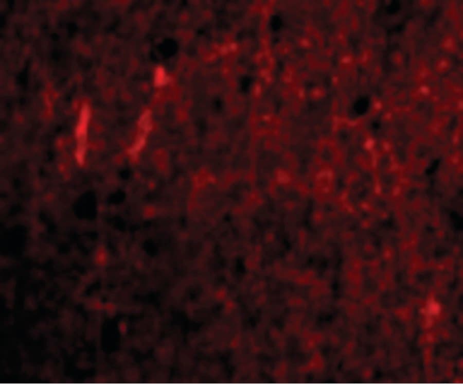 CDNF / ARMETL1 Antibody