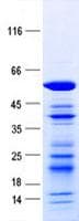 Human MYOZ2 / CS-1 Protein (Recombinant GST-His, N-terminus)