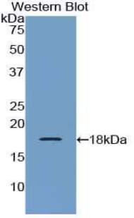 IL6R / IL6 Receptor Antibody (aa205-347)