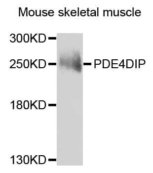 Polyclonal Rabbit anti-Human PDE4DIP / MMGL Antibody (IHC, WB)
