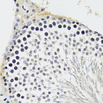 CREBBP / CREB Binding Protein Antibody