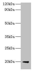 Polyclonal Rabbit anti-E. coli luxS Antibody (WB)