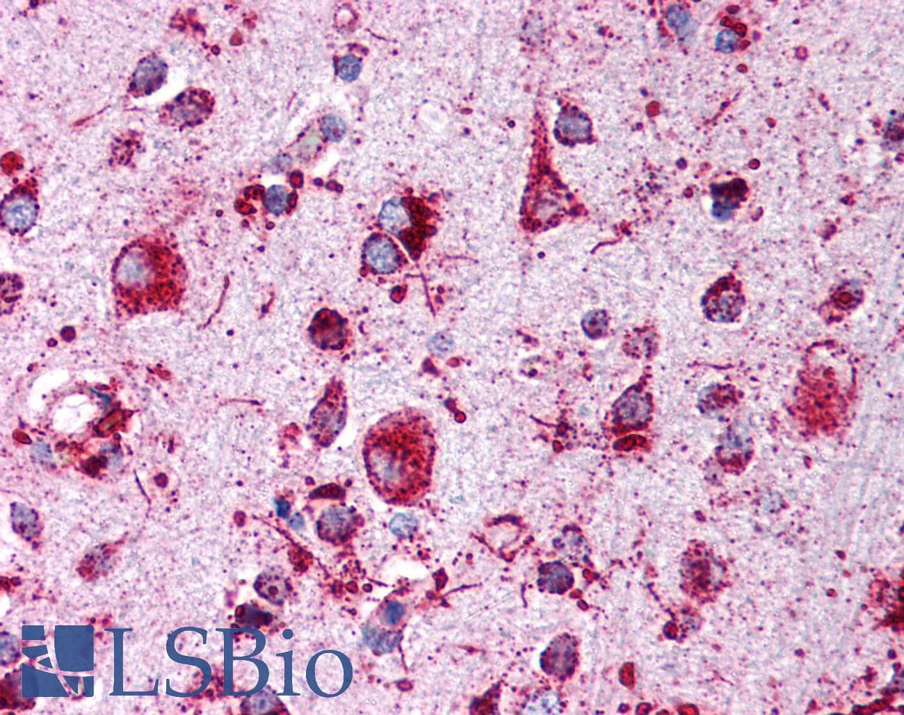 IHC-plus™ LIMPII / SCARB2 Antibody (C-Terminus)