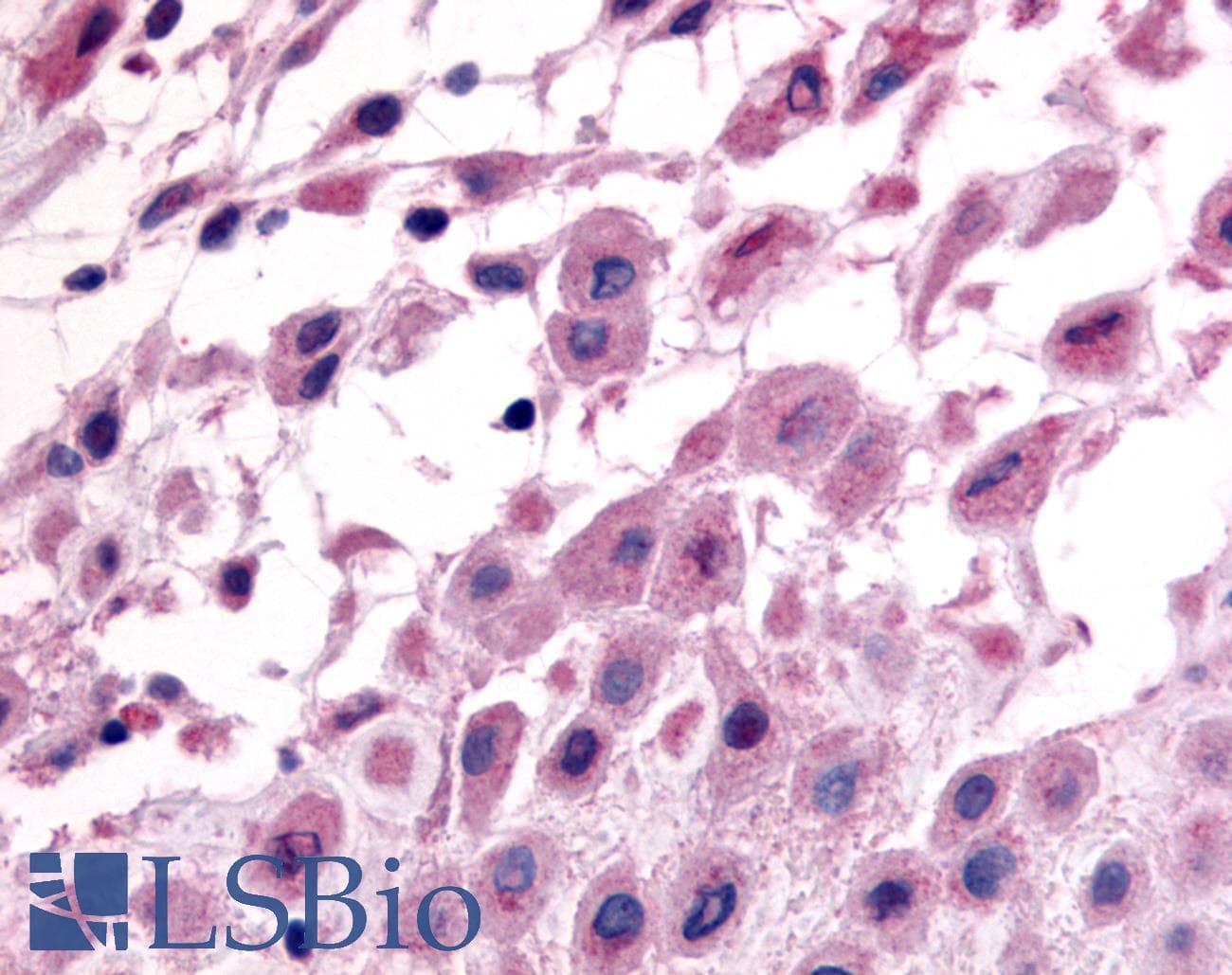 IHC-plus™ Polyclonal Rabbit anti-Human NEP / DDR1 Antibody (Internal, IHC)