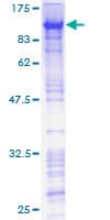 Human ZNF143 / STAF Protein (Recombinant GST)