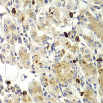 Polyclonal Rabbit anti-Human MMP9 / Gelatinase B Antibody (IHC, WB)