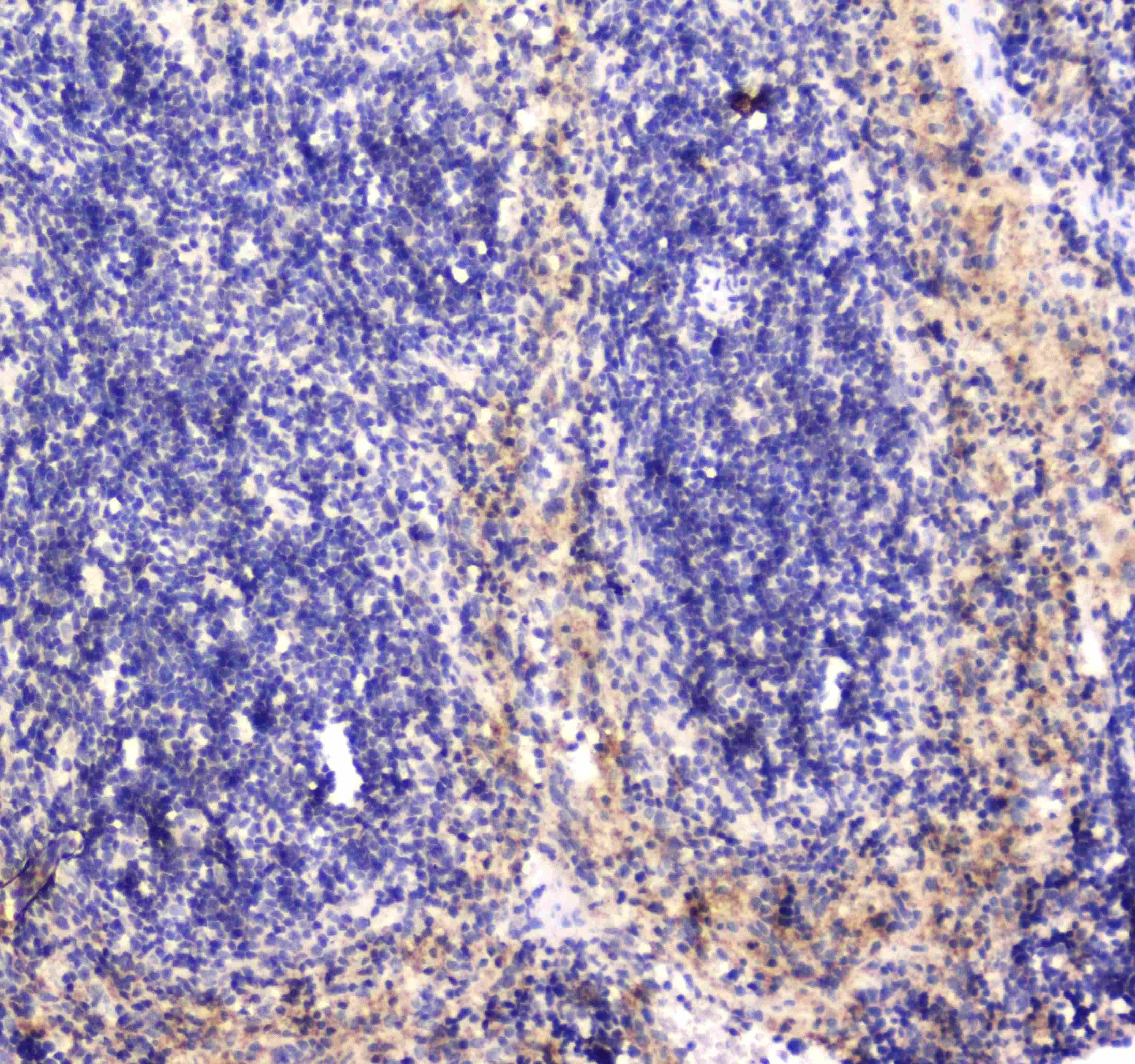 Polyclonal Rabbit anti-Human RAB27A / RAB27 Antibody (IHC, WB)