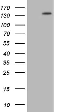 PALB2 Antibody (aa1-287, clone OTI1E7)
