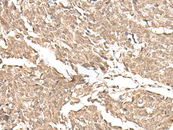 JHDM1A / KDM2A Antibody