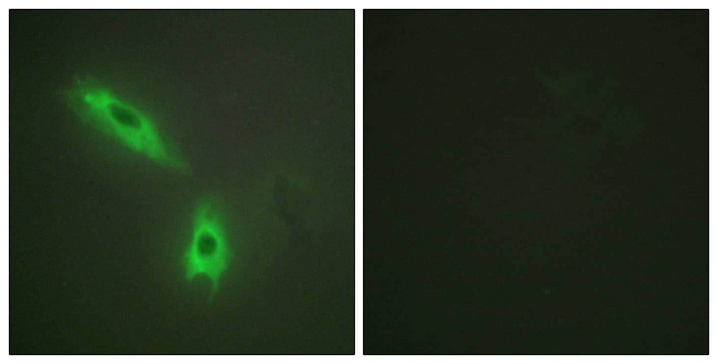 Lymphotoxin-Beta / LTB Antibody (aa181-230)
