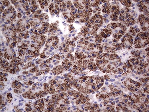 PRX-1 / PRRX1 Antibody (clone OTI1E10)