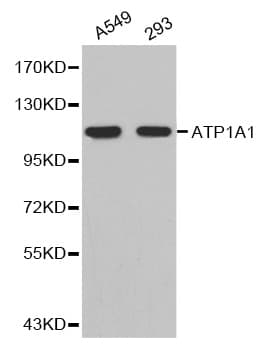 IHC-plus™ ATP1A1 Antibody