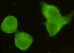 CRTC1 / MECT1 / TORC1 Antibody