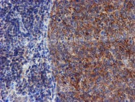 VCAM1 / CD106 Antibody (clone OTI4E8)