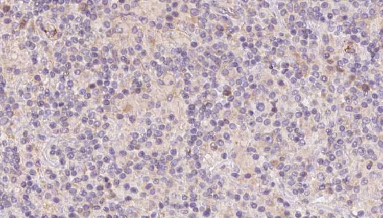 Polyclonal Rabbit anti-Human DNAJB3 Antibody (IHC, WB)