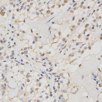Polyclonal Rabbit anti-Human MSH2 Antibody (IHC, IF, WB)