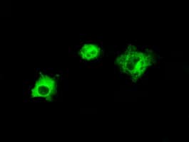 LIPG / Endothelial Lipase Antibody (clone OTI9C5)