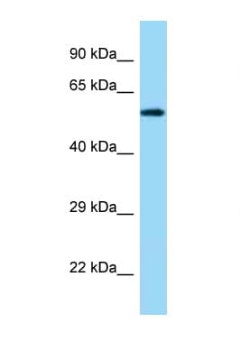 Polyclonal Rabbit anti-Human PDIA3 / ERp57 Antibody (C-Terminus, WB)