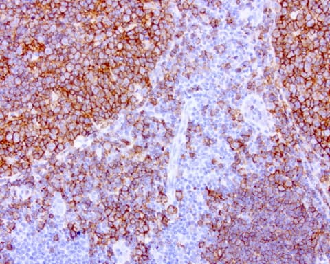 CD20 Antibody (clone UMAB37)