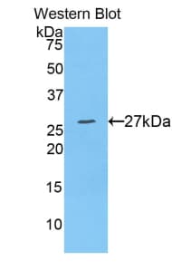 ADAM10 Antibody (aa218-445)