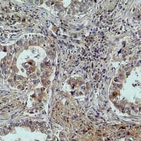MICU1 / CBARA1 Antibody