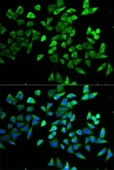 TCF19 / TCF-19 Antibody