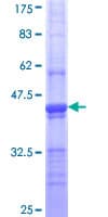 Human CLTC / Clathrin Heavy Chain Protein (Recombinant GST, N-terminus)