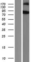SH2B2 / APS Protein (Over-Expression Lysate Myc-DDK (Flag))