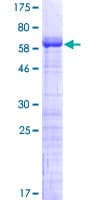Human MAGEB2 Protein (Recombinant GST)