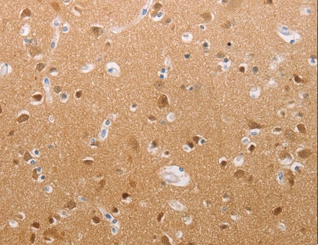 Polyclonal Rabbit anti-Human PFN2 / Profilin 2 Antibody (IHC, WB)