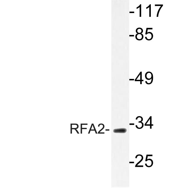 RPA2 / RFA2 / RPA34 Antibody (Ala17)