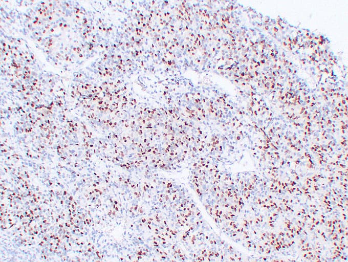 MYOG / Myogenin Antibody (clone ABT-MYOG)