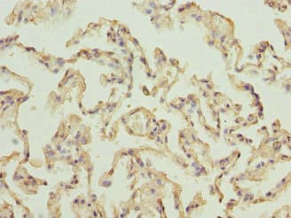 RPLP2 Antibody