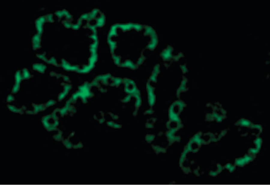 PathPlus™ ACE2 / ACE-2 Antibody
