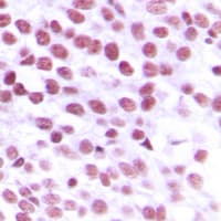 NBN / Nibrin Antibody (Internal)