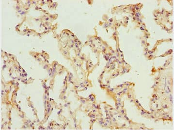 SHOX2 Antibody (aa72-331)