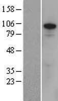 ZFX Protein (Over-Expression Lysate Myc-DDK (Flag))