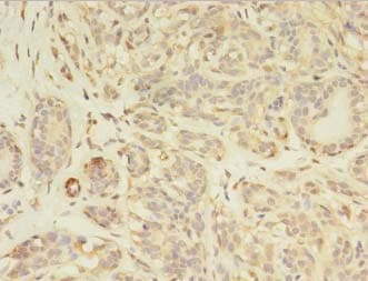 PDGFRB / PDGFR Beta Antibody