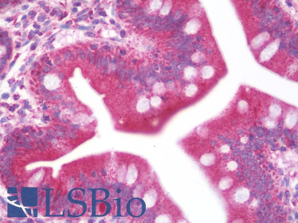 PathPlus™ SLC40A1 / Ferroportin-1 Antibody (Internal)