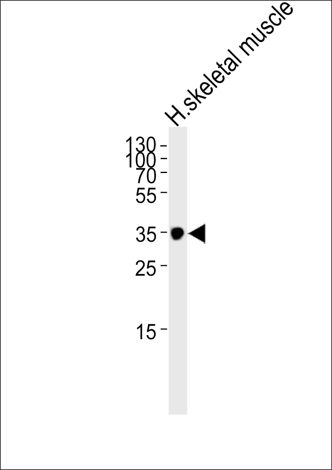 Polyclonal Rabbit anti-Human IFNGR2 Antibody (aa308-337, IHC, WB)