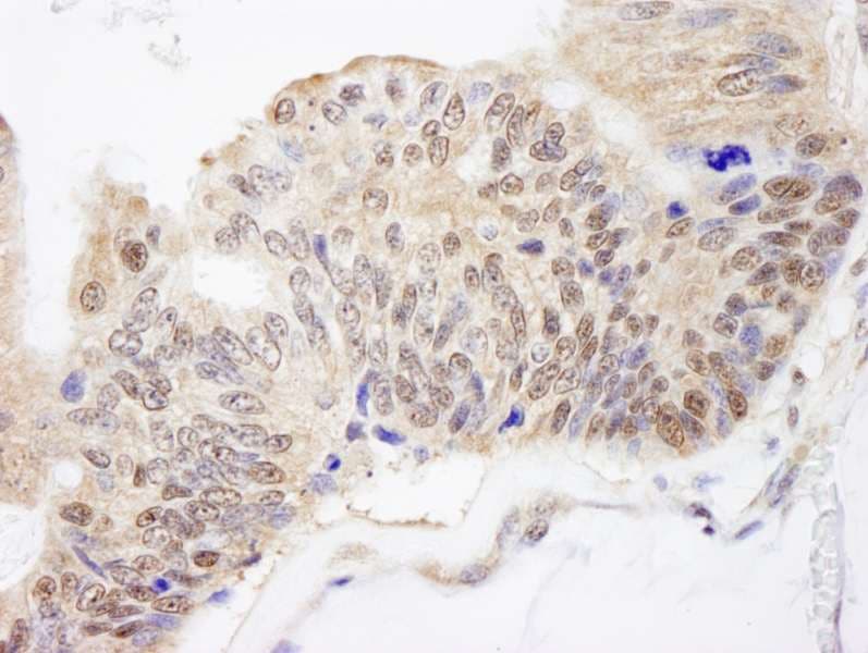 IHC-plus™ Polyclonal Rabbit anti-Human FKBP4 / FKBP52 Antibody (aa1-50, IHC, IF)