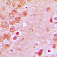 TNFAIP8 / SCC-S2 Antibody (Internal)