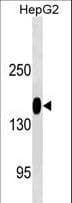ANPEP / CD13 Antibody (aa156-184)