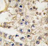 Polyclonal Rabbit anti-Human EPHA10 / EPH Receptor A10 Antibody (aa149-179, IHC, WB)