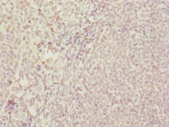 Polyclonal Rabbit anti-Human SUPT4H1 / SPT4 Antibody (IHC)