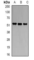Polyclonal Rabbit anti-Human HMBS / PBGD Antibody (WB)