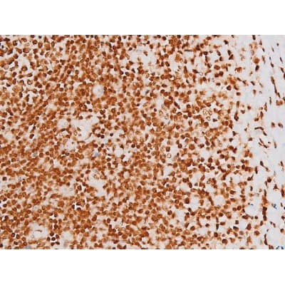 REL / C-Rel Antibody (phospho-Ser503)