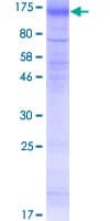 Human SLC26A4 / Pendrin Protein (Recombinant GST)